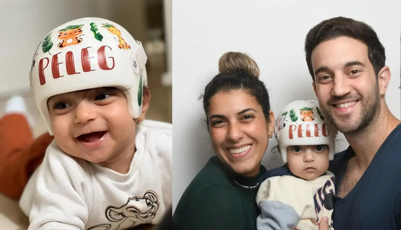 Happy family with baby wearing decorated cranial orthosis for plagiocephaly treatment